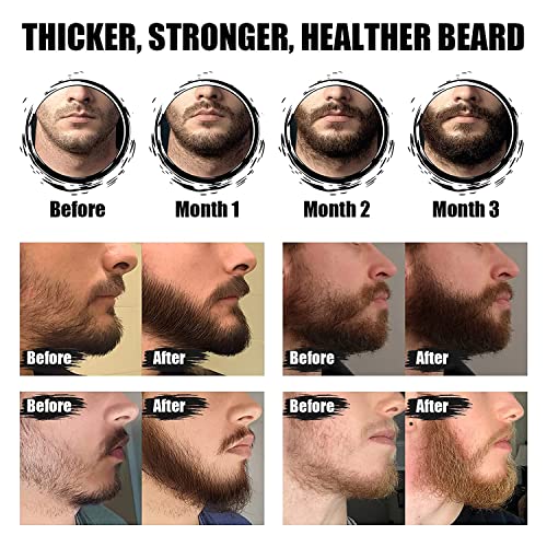 Комплект за растеж на брада за мъже - Масло за оформяне на брада, Балсам за оформяне на брада, Ролка за оформяне на Брада,